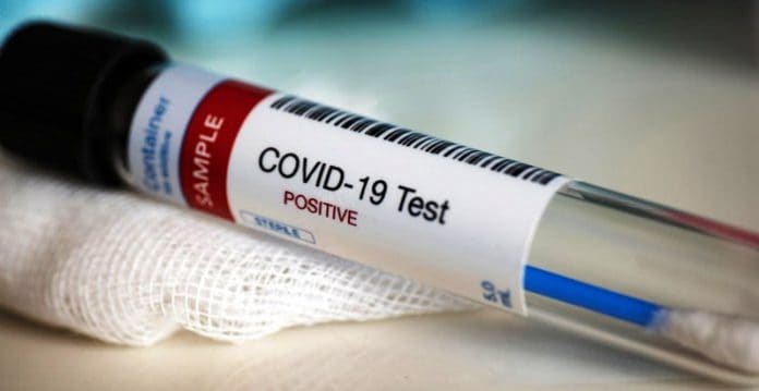 U.S records more than 160k new coronavirus cases on Tuesday.